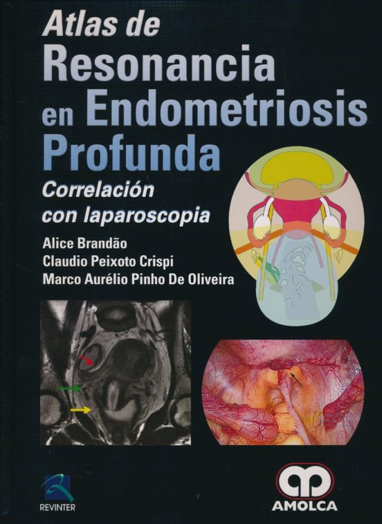 Atlas De Resonancia En Endometriosis Profunda: Correlacion Con Laparos