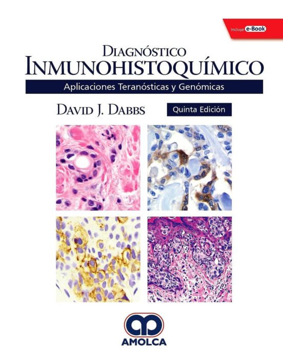 Diagnostico Inmunohistoquimico. Aplicaciones Teranosticas Y Genominas