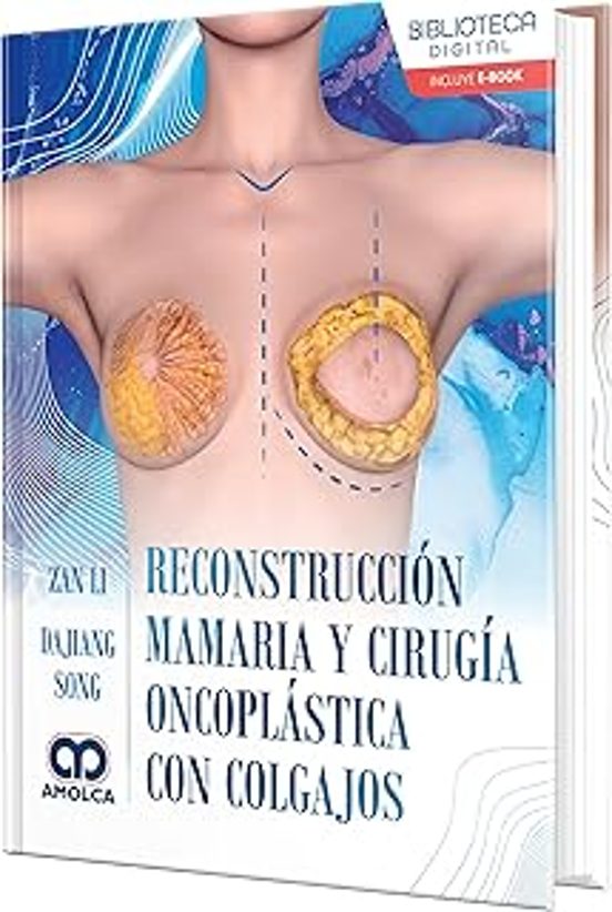 Reconstrucción Mamaria Y Cirugía Oncoplástica Con Colgajos