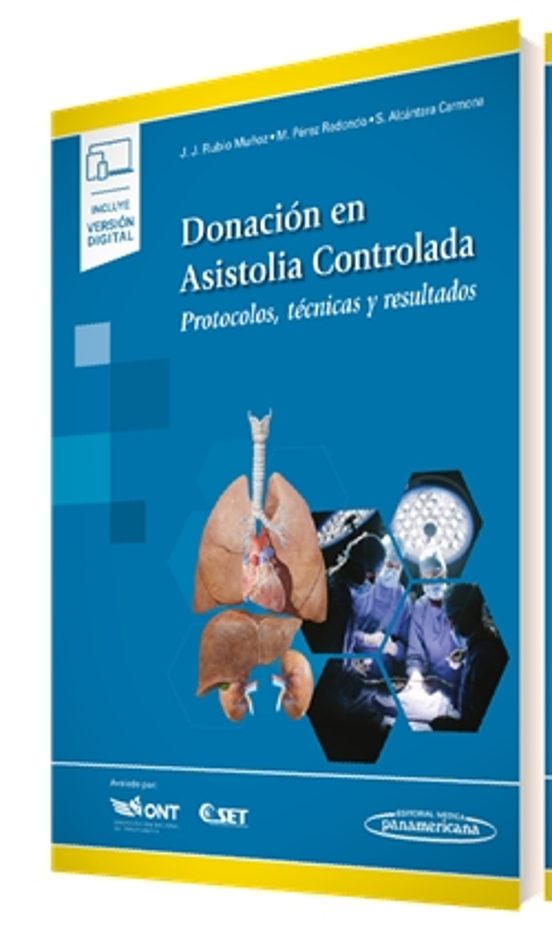 Donación En Asistolia Controlada