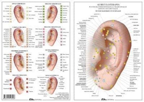 Auriculoterapia