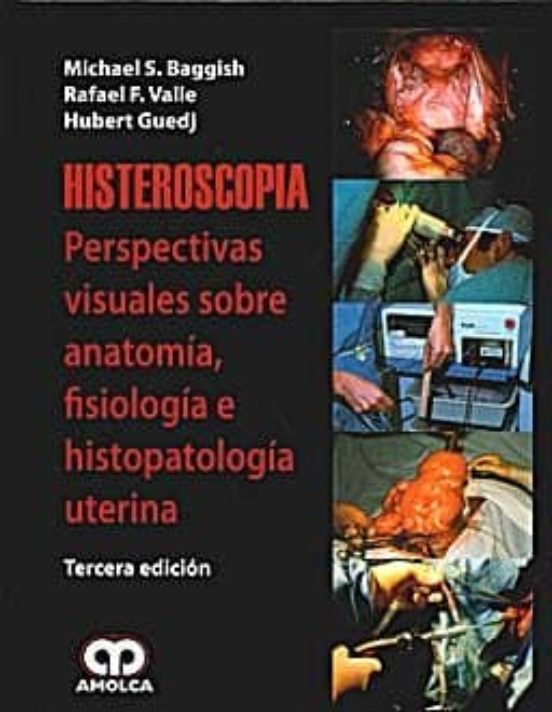 Histeroscopia. Perspectivas Visuales De La Anatomia Fisiologia E E His