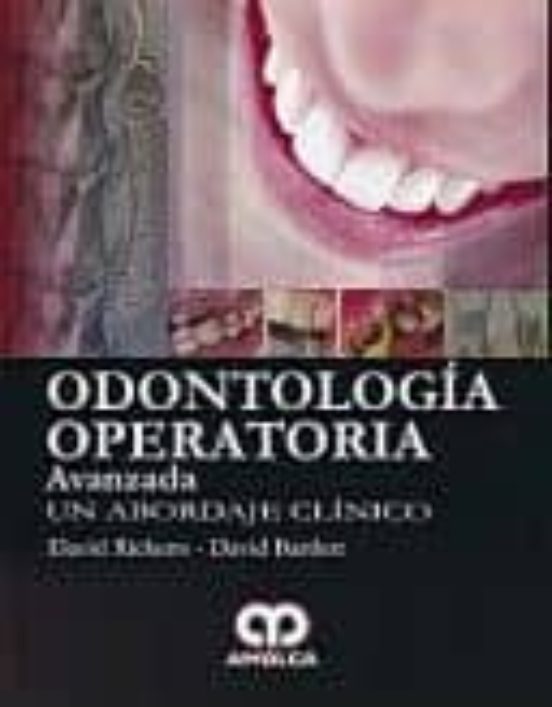 Odontologia Operatoria Avanzada: Un Abordaje Clinico