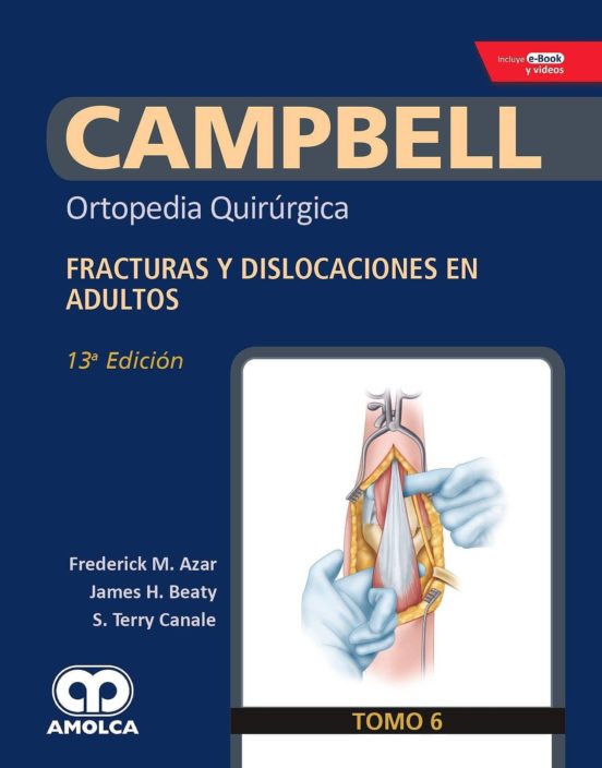 Campbell Ortopedia Quirurgica : Fracturas Y Dislocaciones En A