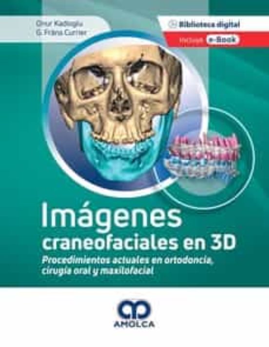 Imágenes Craneofaciales En 3d. Procedimientos Actuales En Ortodoncia C