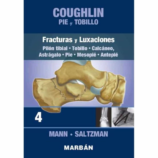 Coughlin Pie Y Tobillo 4. Fracturas Y Luxaciones. Pilón Tibial. Tobill