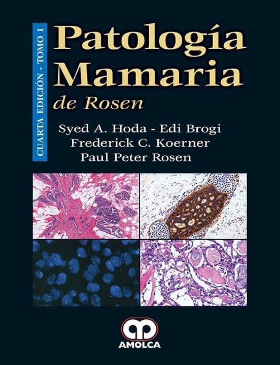 Patologia Mamaria De Rosen