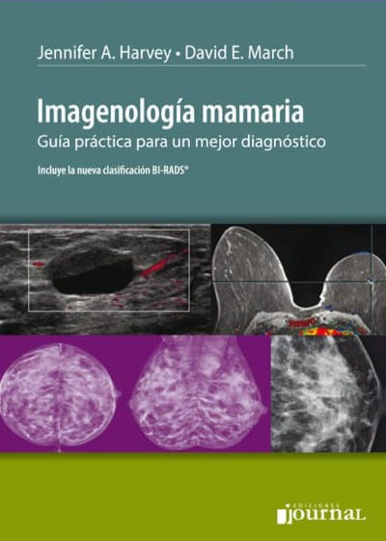 Imagenologia Mamaria: Guia Practica Para Un Mejor Diagnostico