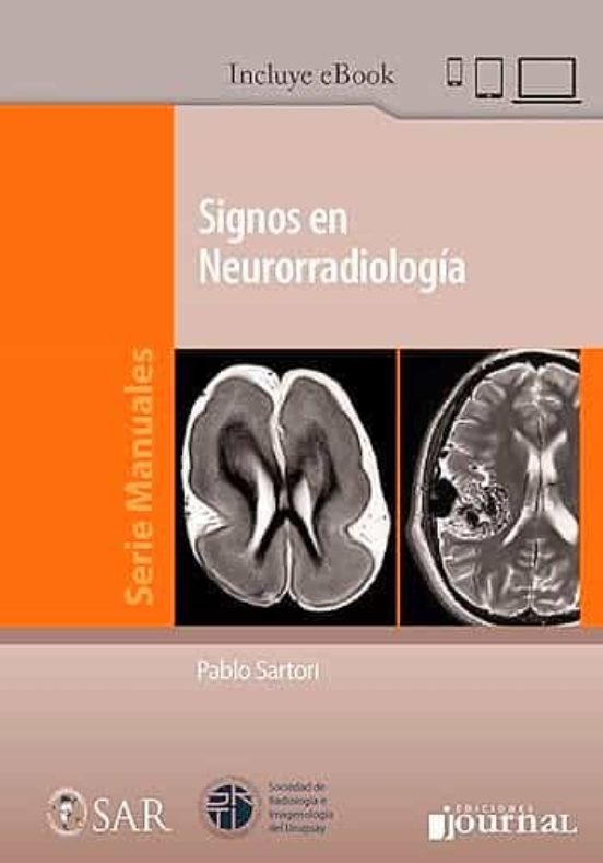 Signos En Neurorradiologia