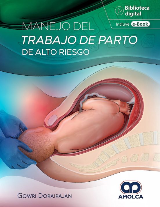 Manejo Del Trabajo De Parto De Alto Riesgo