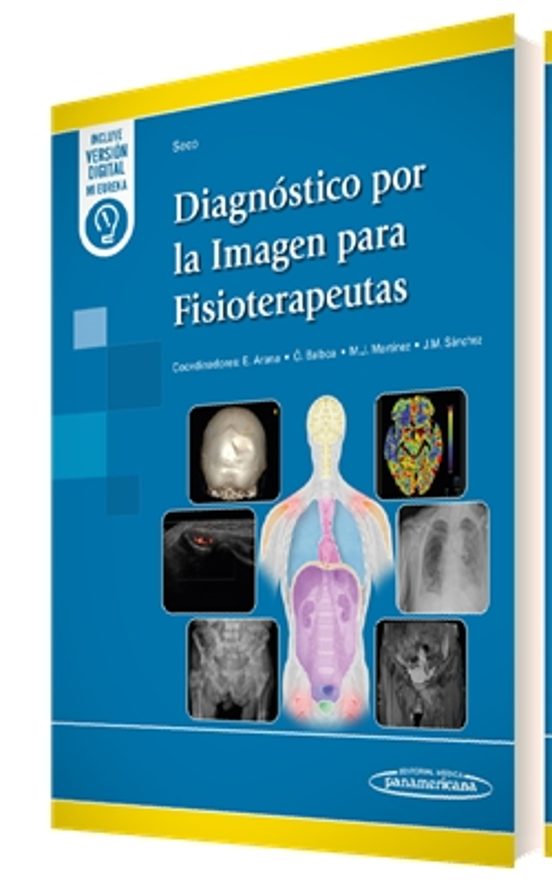 Diagnóstico Por La Imagen Para Fisioterapeutas