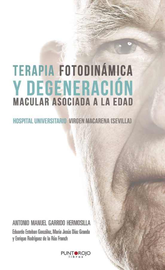 Terapia Fotodinámica Y Degeneración Macular Asociada A La Edad