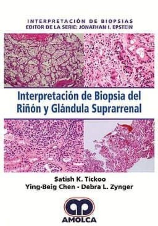 Interpretacion De Biopsia Del Riñon Y Glandula Suprarrenal
