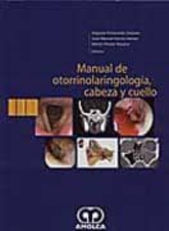 Manual De Otorrinolaringologia Cabeza Y Cuello