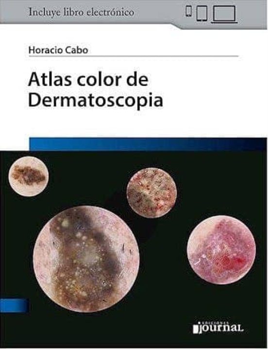 Atlas Color De Dermatoscopia