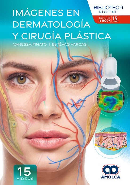 Imágenes En Dermatología Y Cirugía Plástica