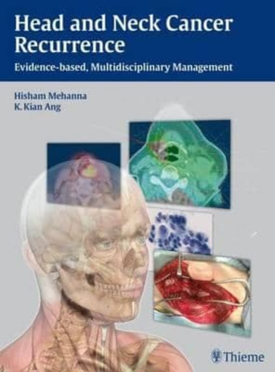Head And Neck Cancer Recurrence: Evidence-based Multidisciplinar Y Man