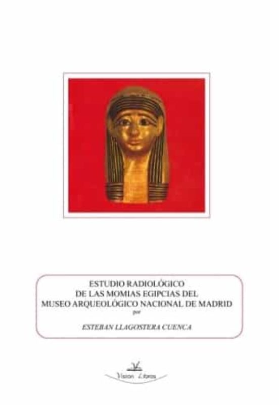 Estudio Radiológico De Las Momias Egipcias Del Museo Arqueológico Nacional De Madrid