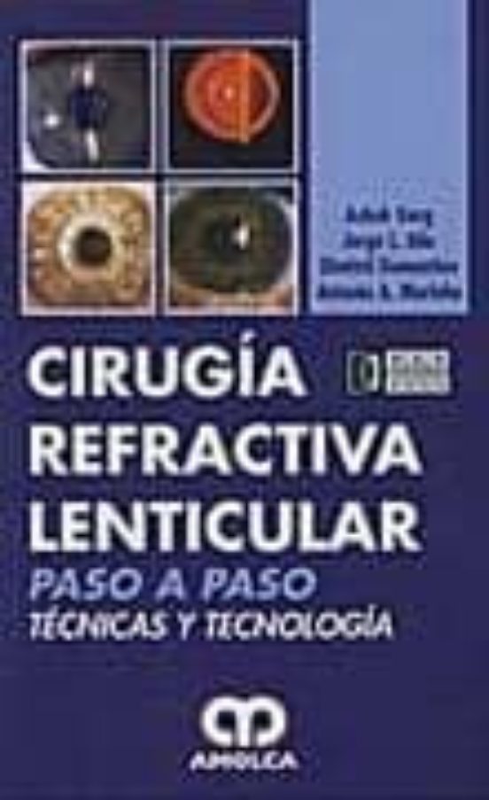 Cirugia Refractiva Lenticular: Paso A Paso