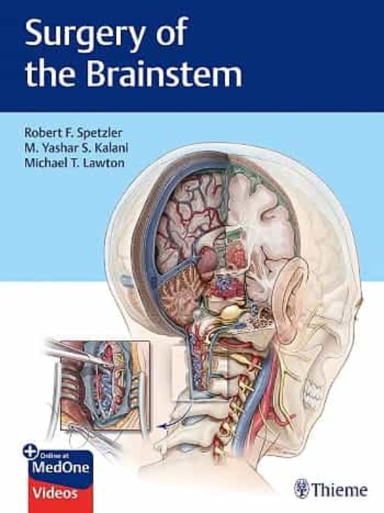 Surgery Of The Brainstem + Online At Medone Videos