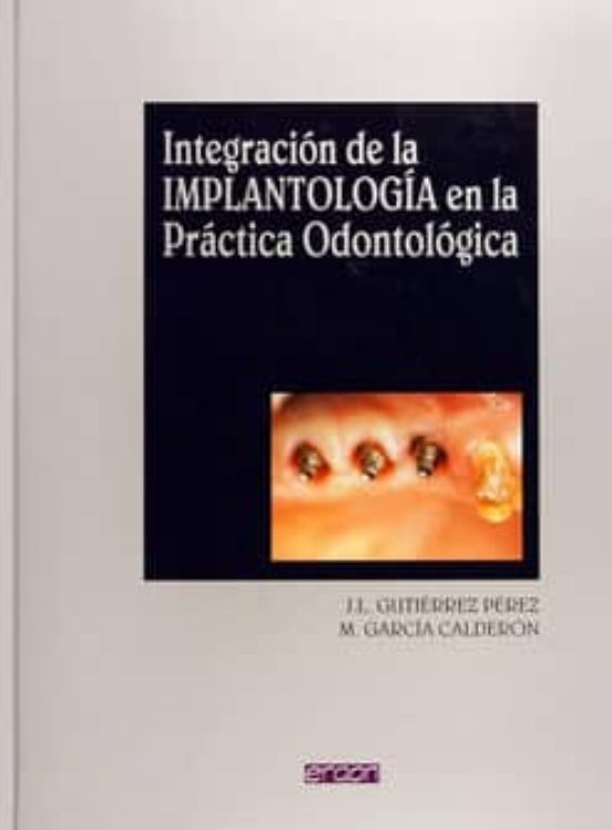 Integración De La Implantología En La Práctica Odontológica