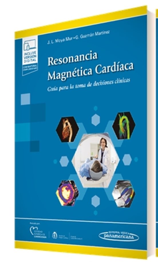 Resonancia Magnetica Cardiaca