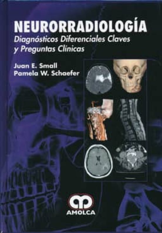 Neurorradiologia