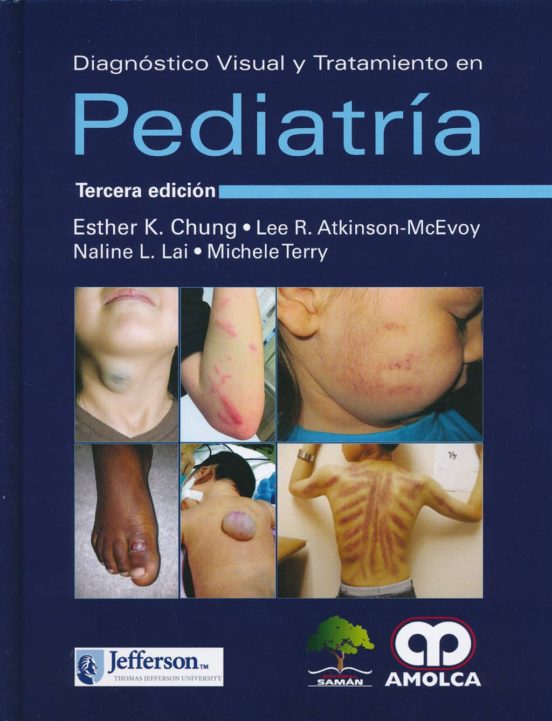 Diagnostico Visual Y Tratamiento En Pediatria