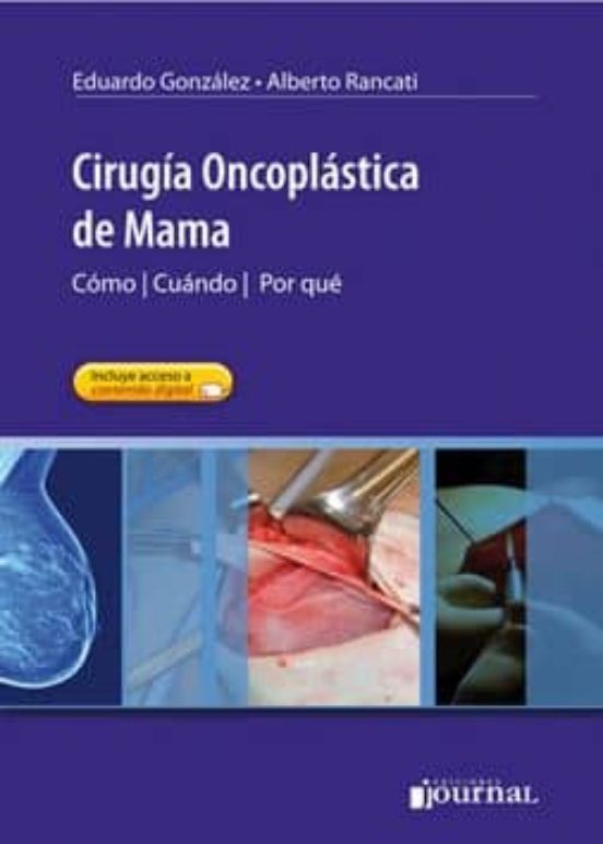 Cirugia Oncoplastica De Mama: Como Cuando Por Que