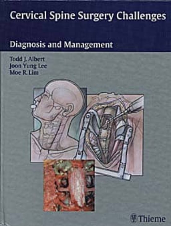 Cervical Spine Surgery Challenges