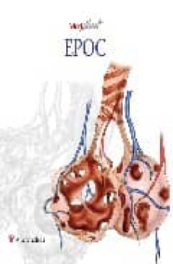 Epoc