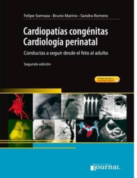 Cardiopatias Congenitas. Cardiologia Perinatal. Conductas A Seguir Des