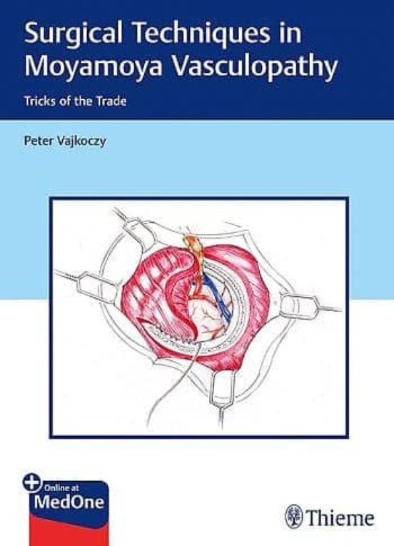 Surgical Techniques In Moyamoya Vasculopathy. Tricks Of The Trade
