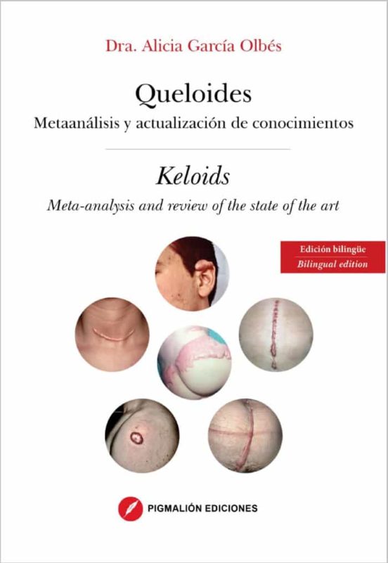 Queloides / Keloids