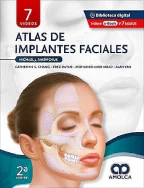Atlas De Implantes Faciales