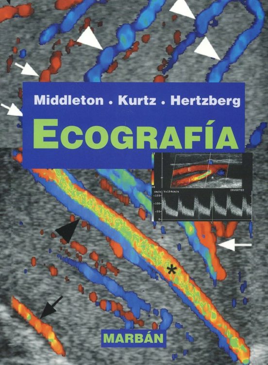 Ecografía