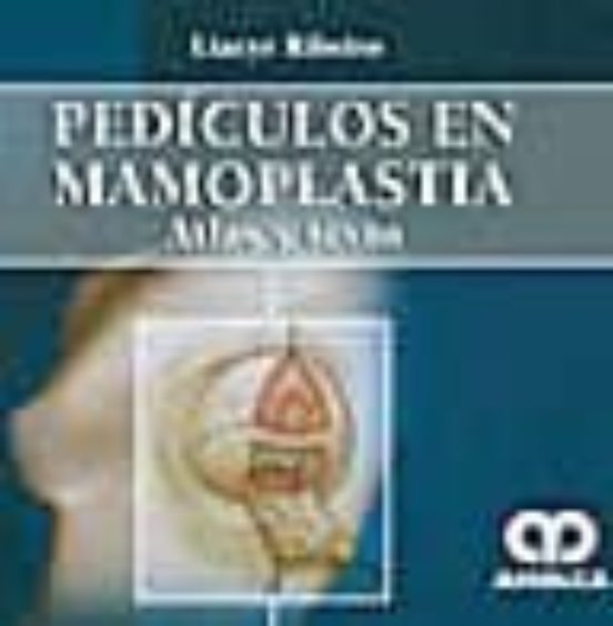 Pediculos En Mamoplastia. Atlas Y Texto