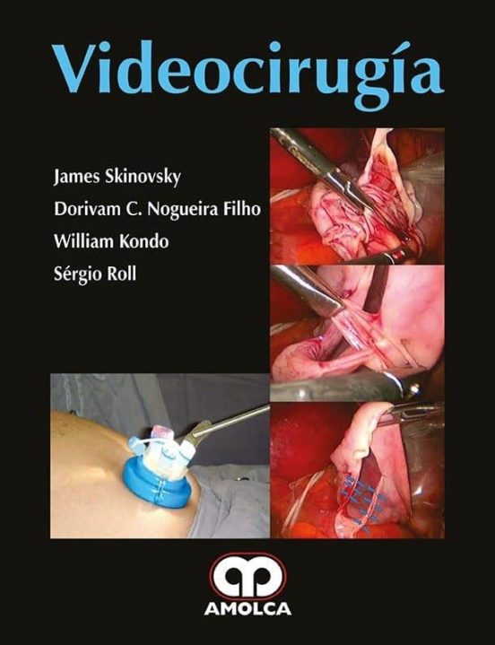 Videocirugia