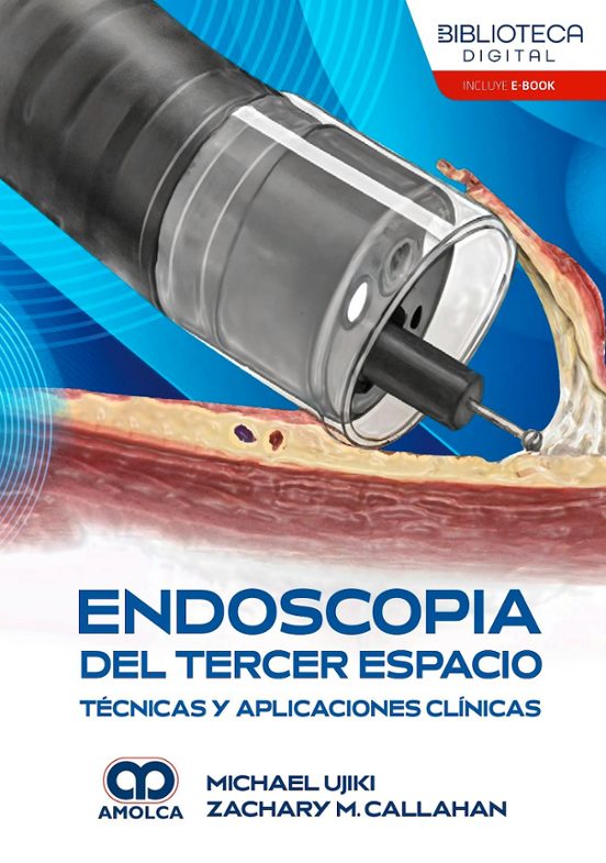 Endoscopia del tercer espacio. Técnicas y aplicaciones clínicas