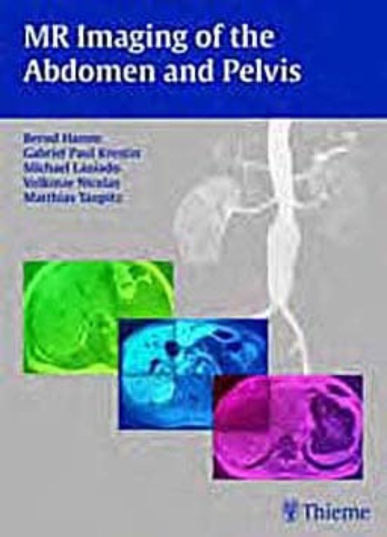 Mr Imaging Of The Adomen And Pelvis