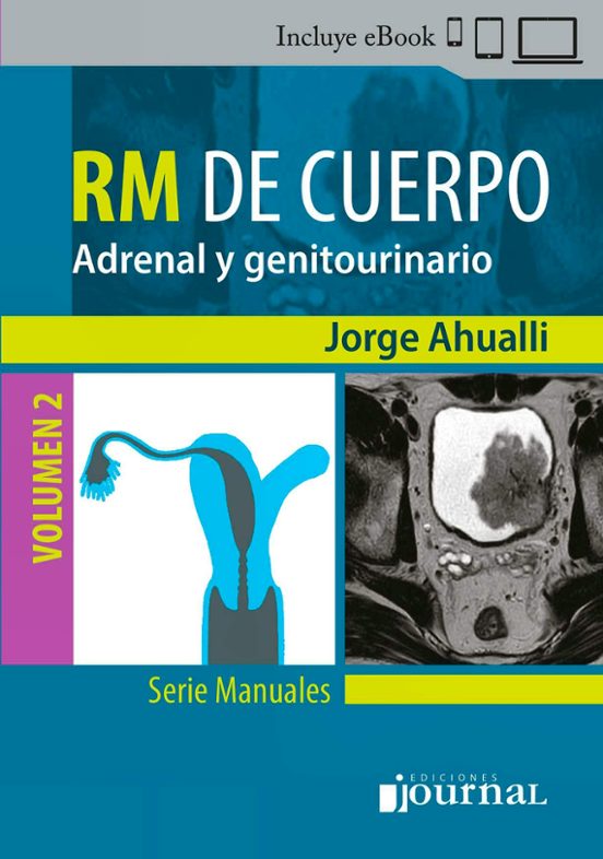 Manual De Rm De Cuerpo. Vol. 2: Adrenal Y Genitourinario