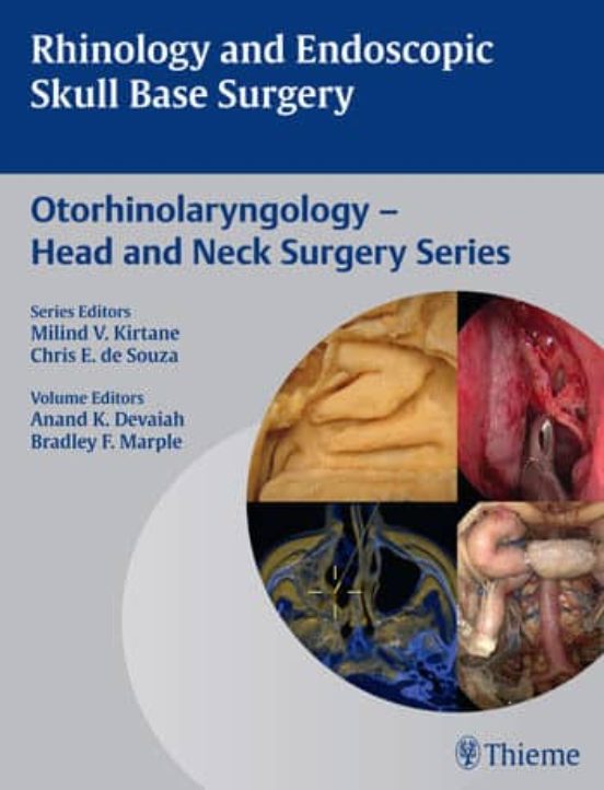 Rhinology And Endoscopic Skull Base Surgery