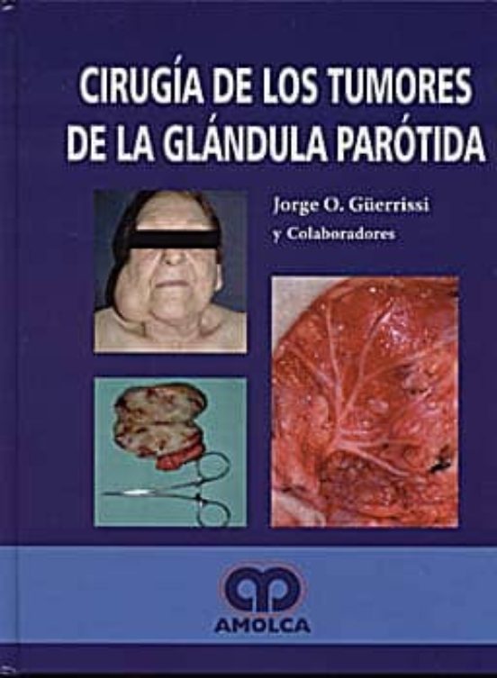 Cirugia De Los Tumores De La Glandula Parotida