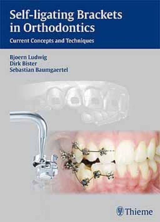 Self-ligating Brackets In Orthodontics: Current Concepts And Tech Niqu