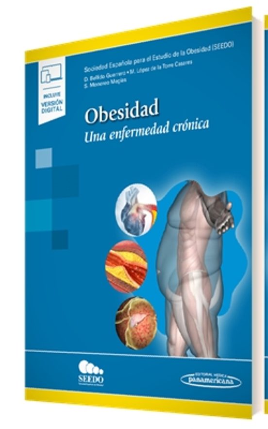 Obesidad