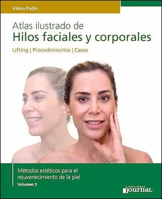 Atlas Ilustrado De Hilos Faciales Y Corporales. Lifting. Procedimiento