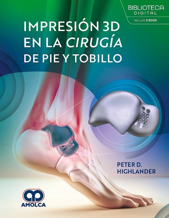 Impresión 3d En La Cirugía De Pie Y Tobillo