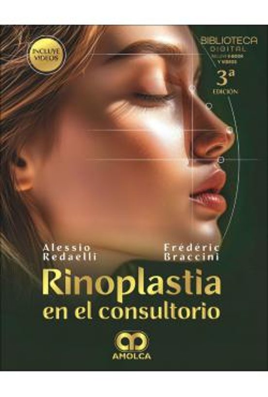 Rinoplastia En El Consultorio