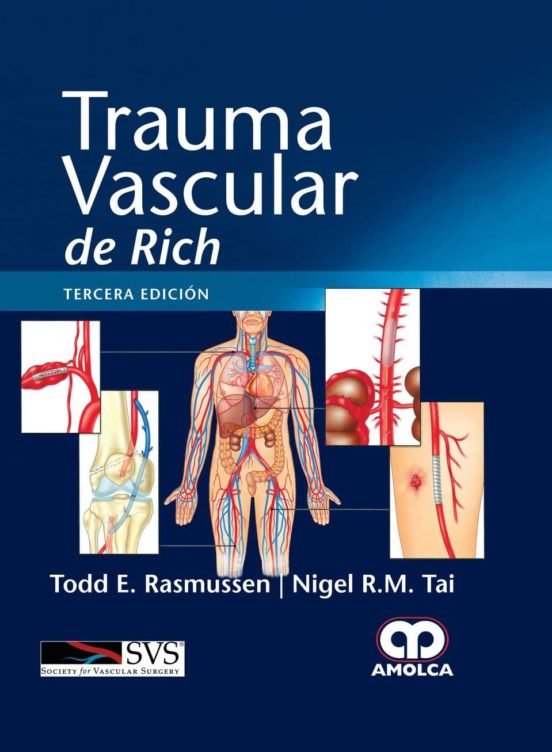 Trauma Vascular De Rich
