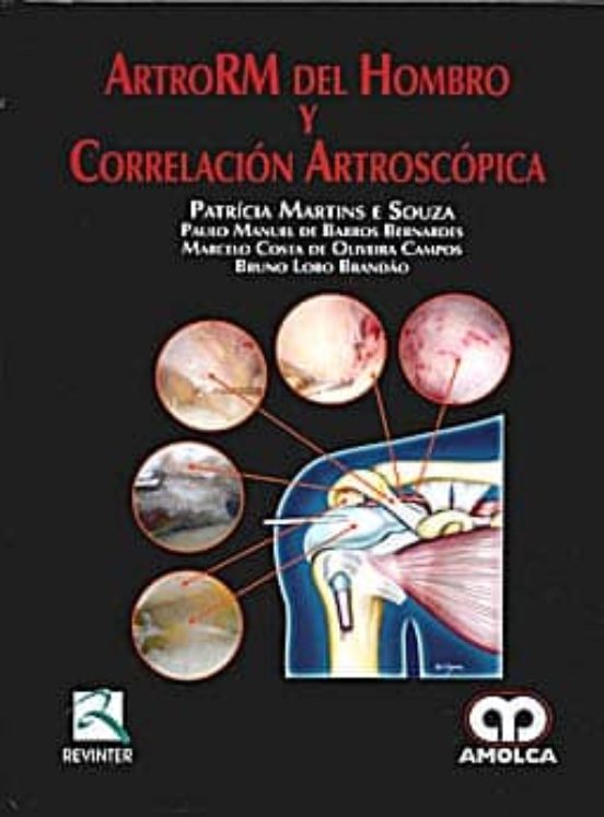 Artrorm Del Hombro Y Correlacion Artroscopica